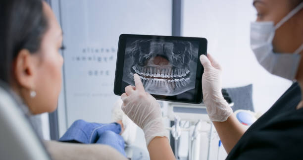 Licensed Teeth Whitening service in South Euclid, OH - Smile Center Dentistry